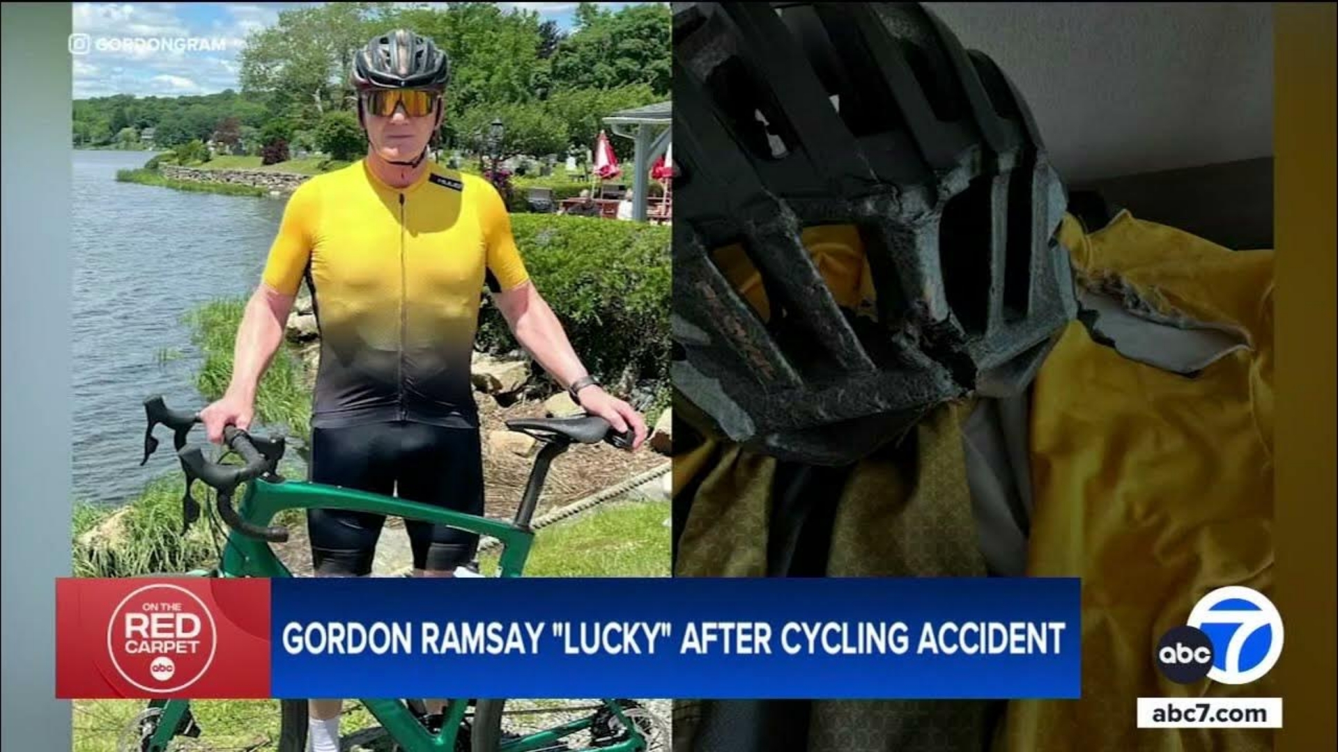 Gordon Ramsay had severe bruises after a nearly fatal bike accident.